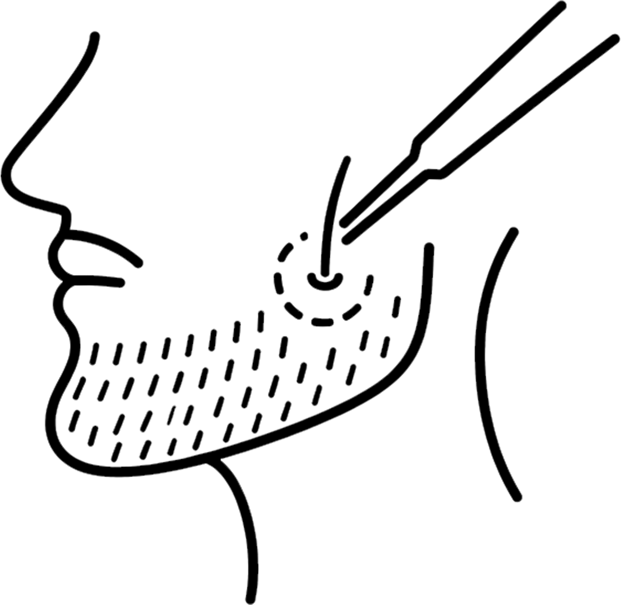 آیکون کاشت ریش